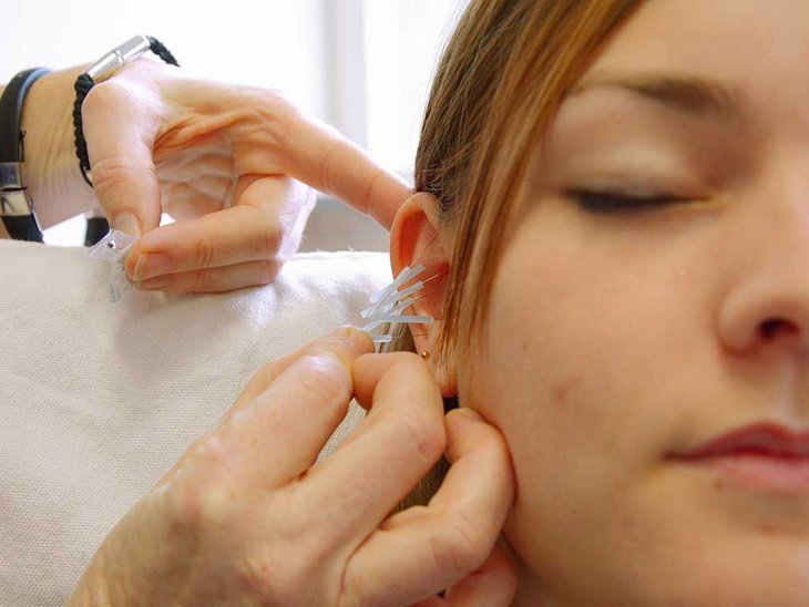 Eine junge Patientin wird in der Abteilung für Abhängigkeitserkrankungen mit Akupunktur behandelt. Man sieht die Hände einer Mitarbeiterin des Bereiches und wie diese die Akupunkturnadeln am Ohr der jungen Patientin befestigen. Diese schließt hierbei die Augen, sie sieht entspannt aus.